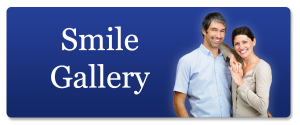 Smile Gallery